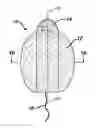 Fig. 01 - INTRAVAGINAL DEVICE WITH FLUID TRANSPORT PLATES AND METHODS OF MAKING