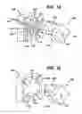 Fig. 12 - INTRAVAGINAL DEVICE WITH FLUID TRANSPORT PLATES AND METHODS OF MAKING