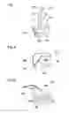 Fig. 05 - Method and equipment for fastening a thread to a tampon