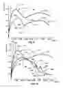 Fig. 08 - Implantable medical pump diagnostics