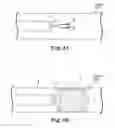 Fig. 04 - Therapeutic agent delivery system and method for localized application of therapeutic substances to a biological lumen