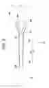 Fig. 04 - Auxiliary dilator and catheter assembly having the same