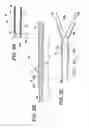 Fig. 07 - Auxiliary dilator and catheter assembly having the same