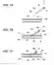 Fig. 08 - Auxiliary dilator and catheter assembly having the same