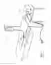 Fig. 02 - Hard tissue ablation system