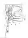 Fig. 07 - Hard tissue ablation system