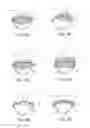 Fig. 06 - METHODS AND ELECTRODE APPARATUS TO ACHIEVE A CLOSURE OF A LAYERED TISSUE DEFECT