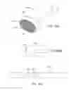 Fig. 49 - METHODS AND ELECTRODE APPARATUS TO ACHIEVE A CLOSURE OF A LAYERED TISSUE DEFECT