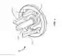 Fig. 06 - Surgical instrument with cycloidal gear system