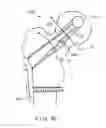 Fig. 12 - Fixation device for treating a bone fracture