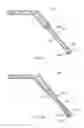 Fig. 13 - Fixation device for treating a bone fracture
