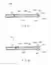 Fig. 14 - Fixation device for treating a bone fracture
