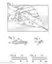 Fig. 02 - REPLACEMENT SYSTEM FOR A SURGICAL WIRE