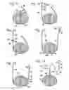 Fig. 04 - REPLACEMENT SYSTEM FOR A SURGICAL WIRE