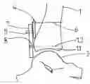 Fig. 01 - Device for in situ milling of joint surfaces