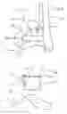 Fig. 09 - Device for in situ milling of joint surfaces