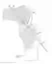 Fig. 09 - Device and method for use during ligament reconstruction