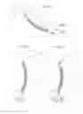 Fig. 10 - Hip joint instrument and method