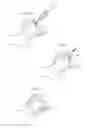 Fig. 22 - Hip joint instrument and method