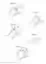 Fig. 23 - Hip joint instrument and method