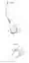 Fig. 32 - Hip joint instrument and method