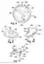 Fig. 06 - System and method for assisting with attachment of a stock implant to a patient tissue