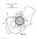 Fig. 07 - System and method for assisting with attachment of a stock implant to a patient tissue