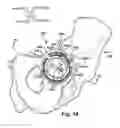 Fig. 09 - System and method for assisting with attachment of a stock implant to a patient tissue