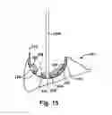 Fig. 10 - System and method for assisting with attachment of a stock implant to a patient tissue