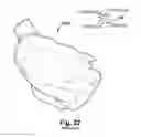 Fig. 12 - System and method for assisting with attachment of a stock implant to a patient tissue