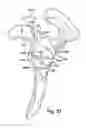Fig. 15 - System and method for assisting with attachment of a stock implant to a patient tissue