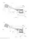 Fig. 08 - Reduced extravasation of bone cement