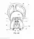 Fig. 04 - Uterine manipulators and related components and methods