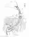 Fig. 15 - Uterine manipulators and related components and methods
