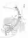 Fig. 16 - Uterine manipulators and related components and methods