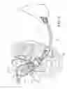 Fig. 17 - Uterine manipulators and related components and methods