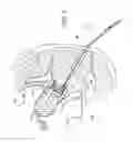Fig. 12 - Uterine Manipulators and Related Components and Methods