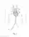 Fig. 02 - Hand operated device for controlled deployment of a tissue anchor and method of using the same