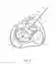 Fig. 04 - Hand operated device for controlled deployment of a tissue anchor and method of using the same