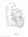 Fig. 05 - Hand operated device for controlled deployment of a tissue anchor and method of using the same