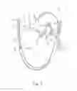 Fig. 07 - Hand operated device for controlled deployment of a tissue anchor and method of using the same