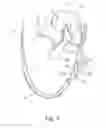 Fig. 09 - Hand operated device for controlled deployment of a tissue anchor and method of using the same