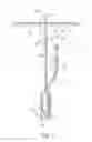 Fig. 10 - Hand operated device for controlled deployment of a tissue anchor and method of using the same