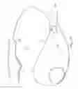 Fig. 11 - Hand operated device for controlled deployment of a tissue anchor and method of using the same