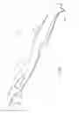 Fig. 14 - Through the scope tension member release clip