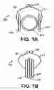 Fig. 02 - Atraumatic clamp