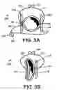 Fig. 04 - Atraumatic clamp