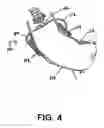 Fig. 05 - Atraumatic clamp