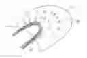 Fig. 01 - Elements for versatility of a prosthetic anchor