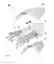 Fig. 04 - Elements for versatility of a prosthetic anchor